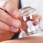 ACA Cupping Service