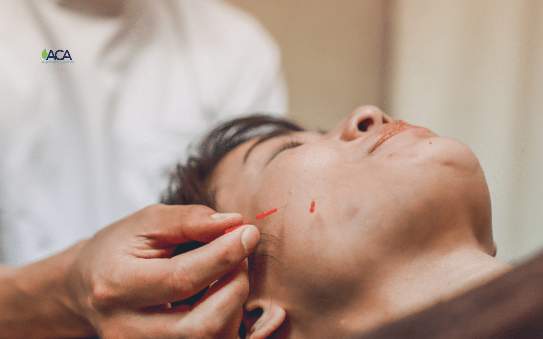 The Benefits Of Acupuncture For Overall Men’s Health
