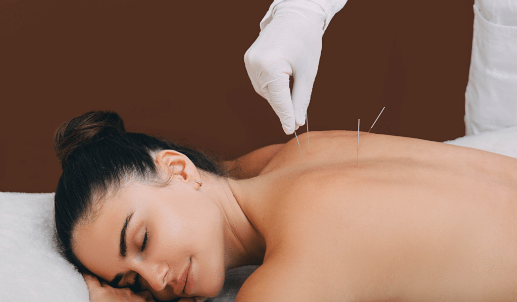 Benefits of Acupuncture for Back Pain
