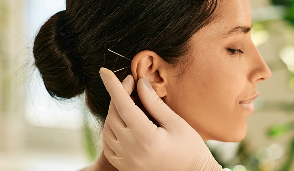 Integrating Acupuncture into a Holistic Wellness Routine | ACA Acupuncture and Wellness