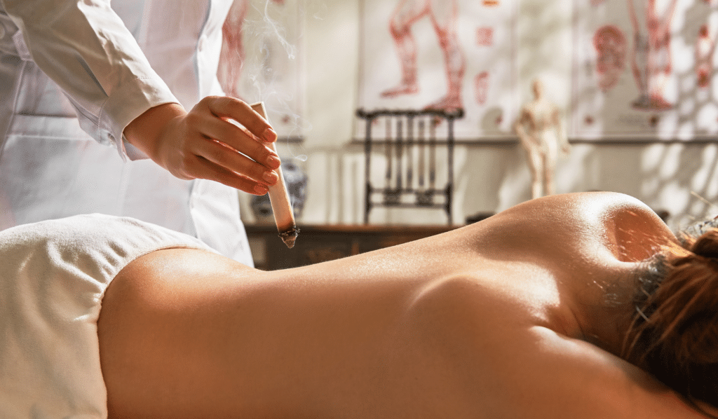 Moxibustion ACA