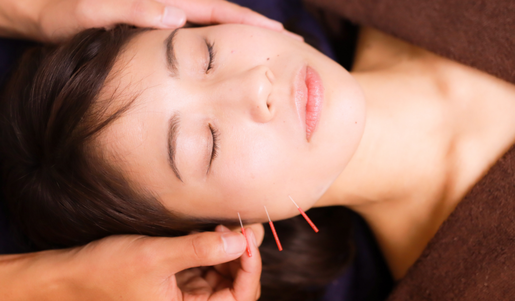 Benefits of Acupuncture vs. Conventional Treatments