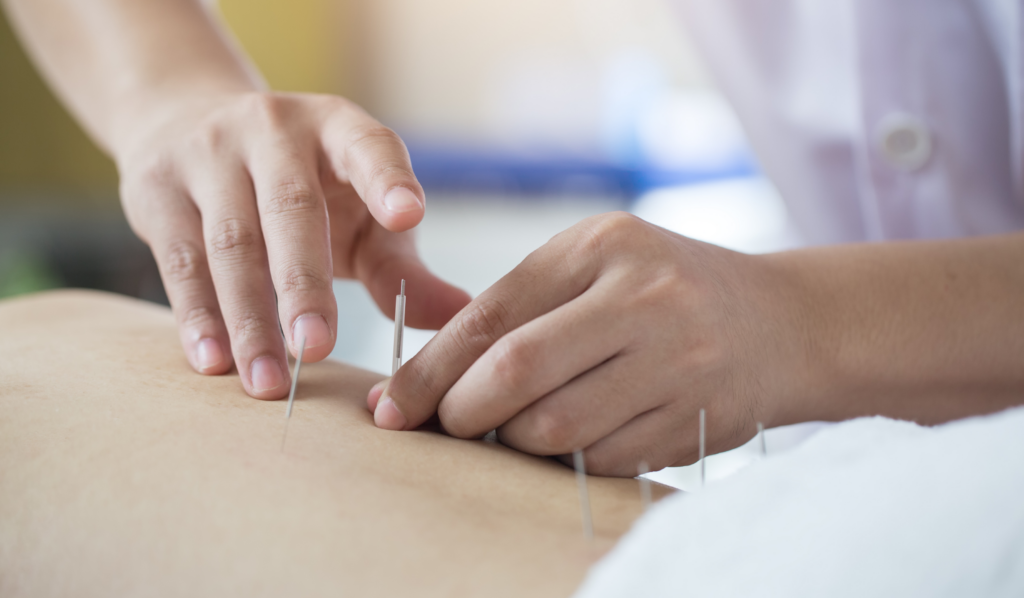 The Role of Traditional Chinese Medicine (TCM) in Weight Management