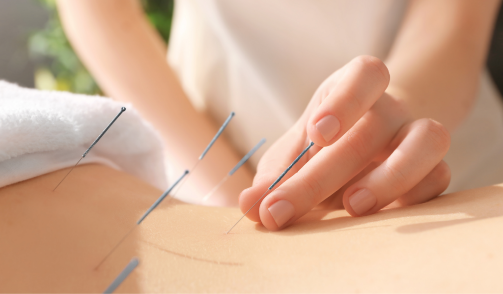 Understanding Depression, Anxiety, and Stress: The Role of Acupuncture | ACA