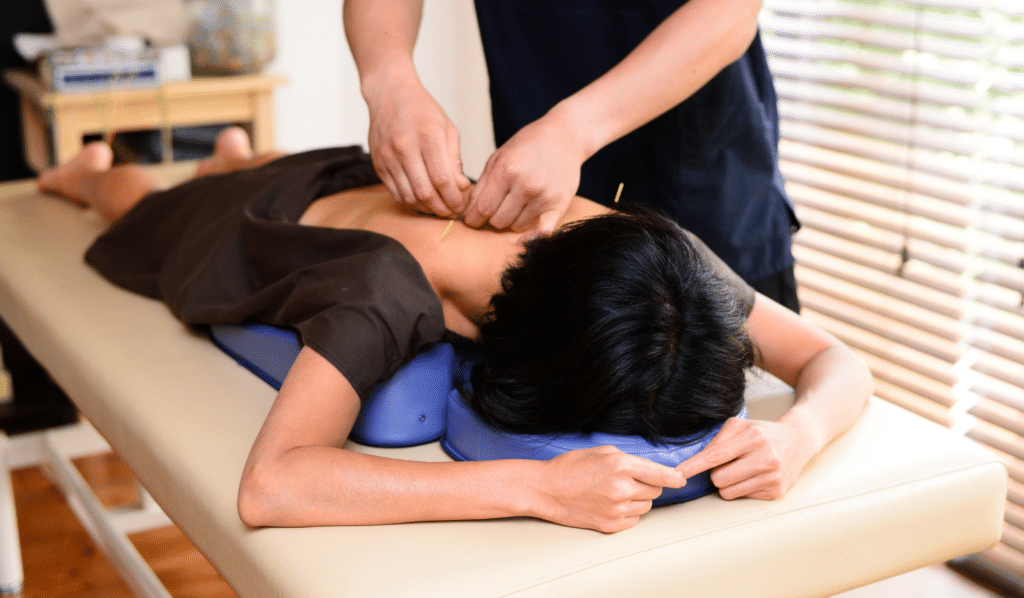 Acupuncture for Muscle Knots and Tension ACA