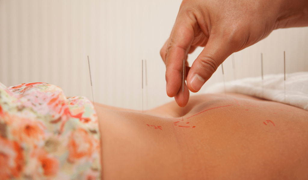 Acupuncture and Acupressure Points for Weight Reduction
