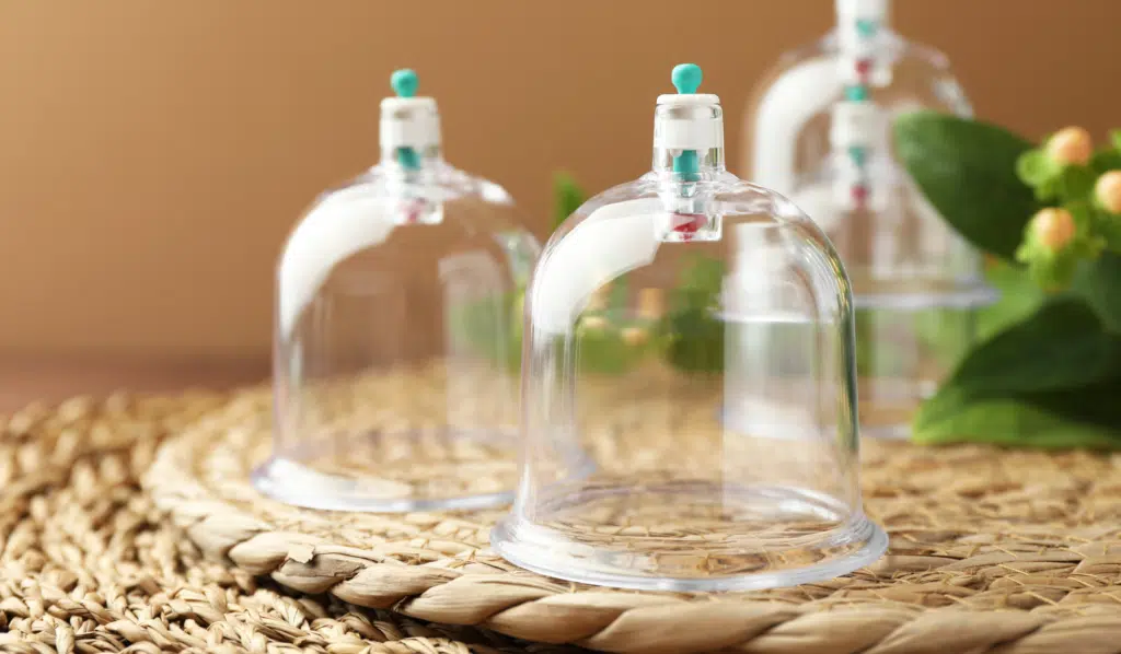 Chinese Cupping Therapy and Post-Cupping Recovery