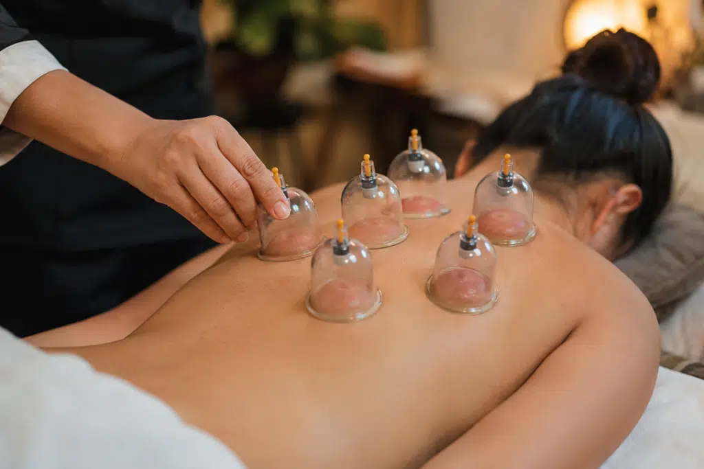 cupping therapy cost