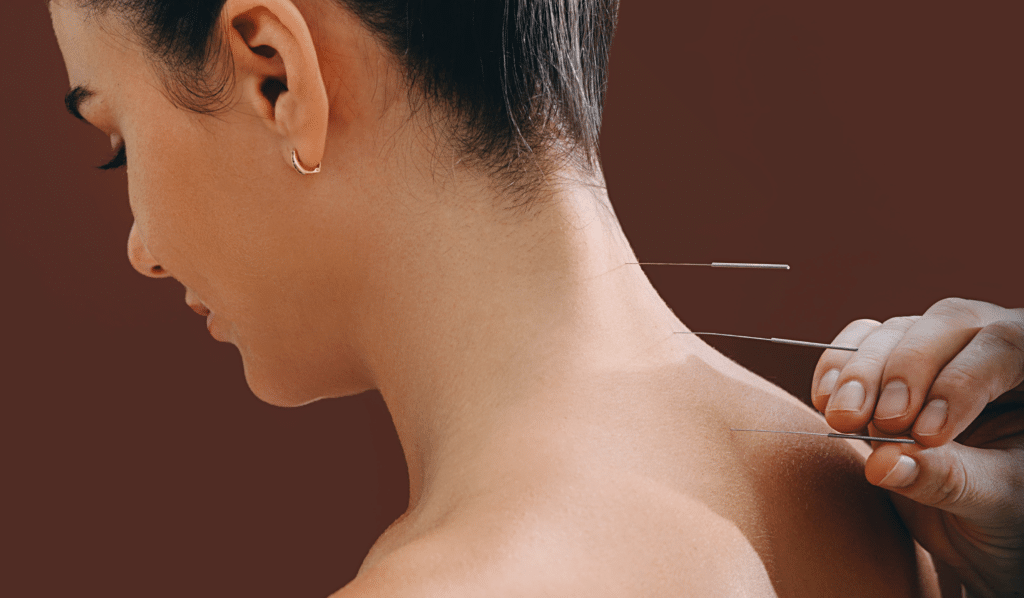 How Acupuncture Works for Neck Pain