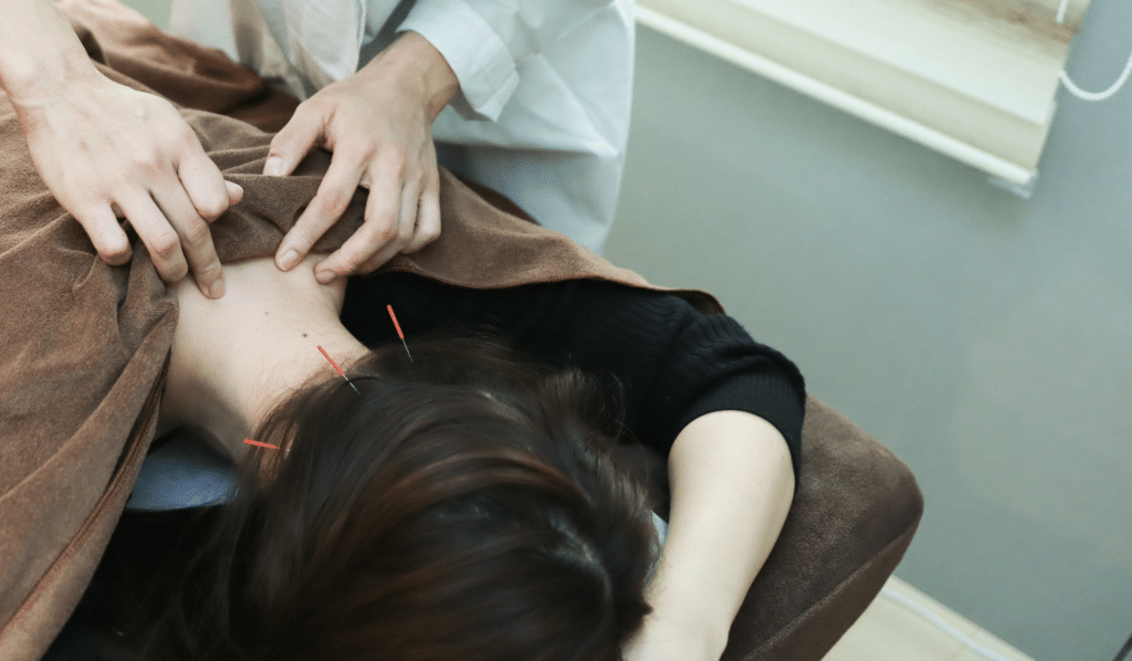 What to Expect During an Acupuncture Treatment Session