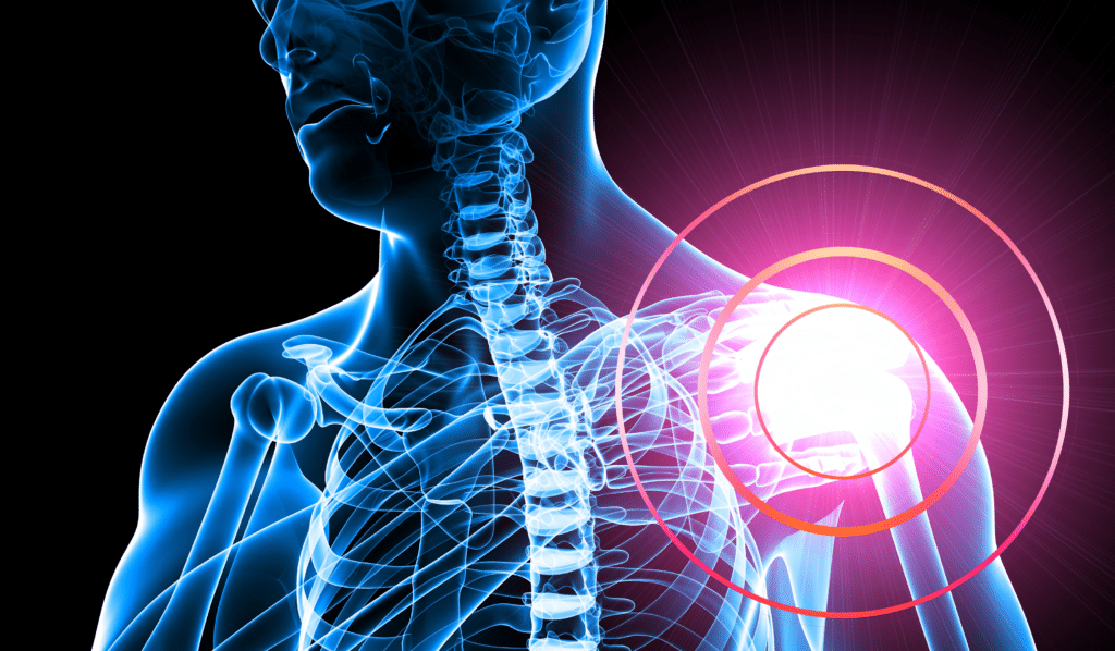 Teres Major Trigger Points