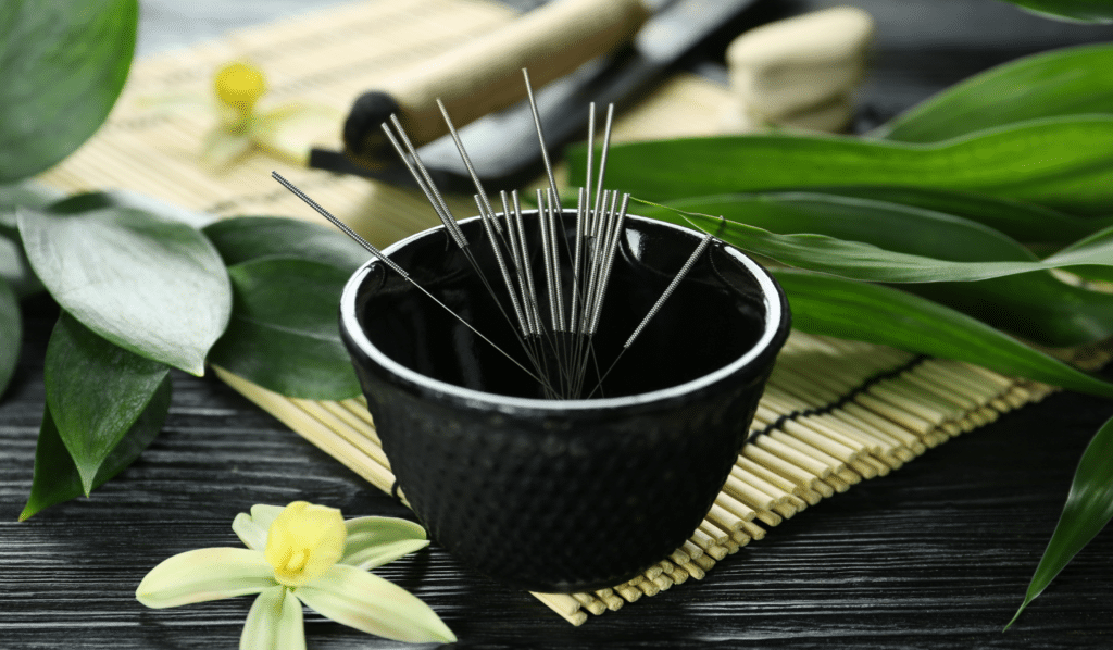Effectiveness of Acupuncture for Various Health Conditions