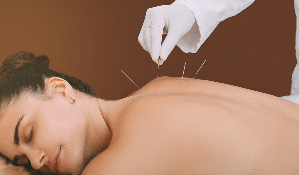 Our Commitment to Holistic Healing at ACA Acupuncture and Wellness