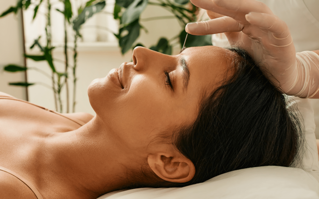 What to Wear to Acupuncture?