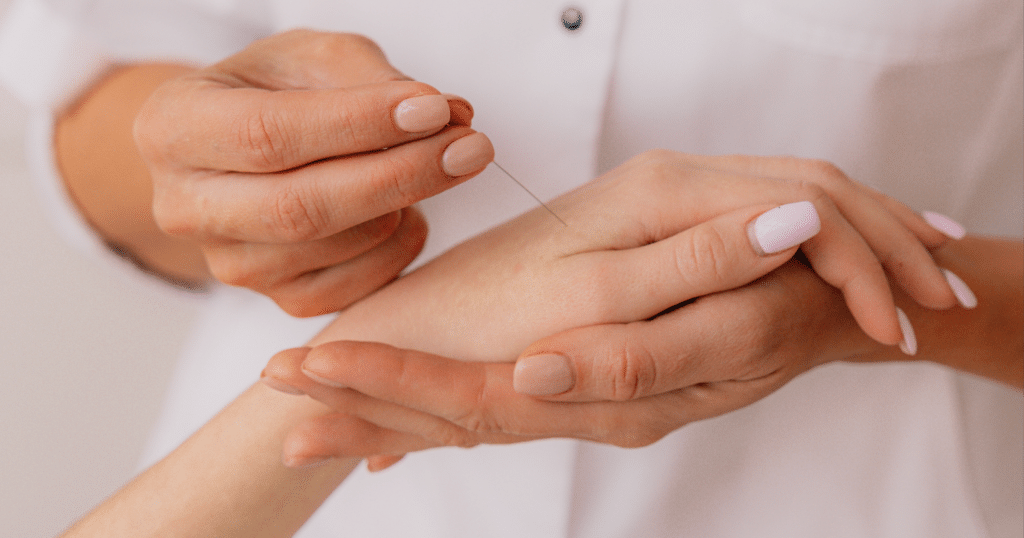 Understanding Acupuncture