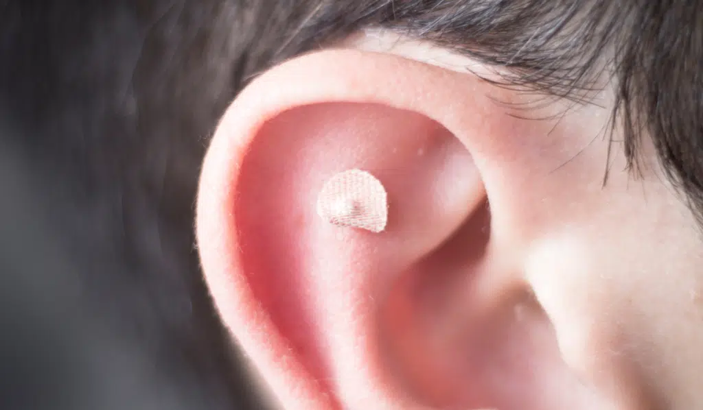 Ear Seeding