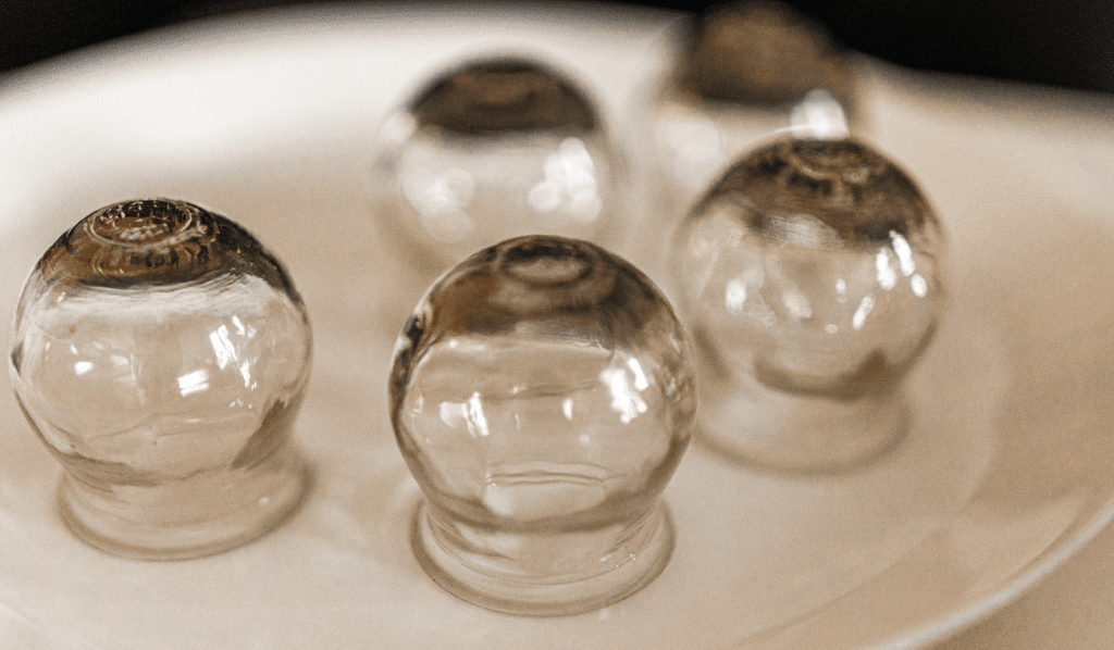 How Often Can You Do Cupping?