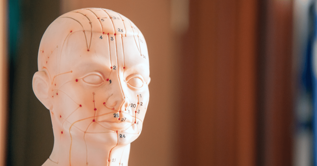 What Are Acupuncture Points?