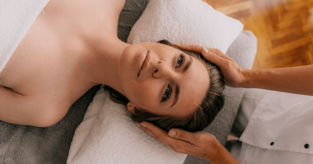 Practical Applications of Acupuncture for Memory Loss