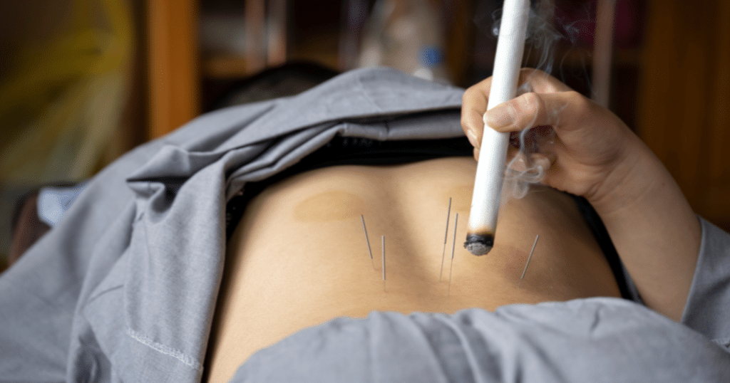 complementary-therapies-in-tcm