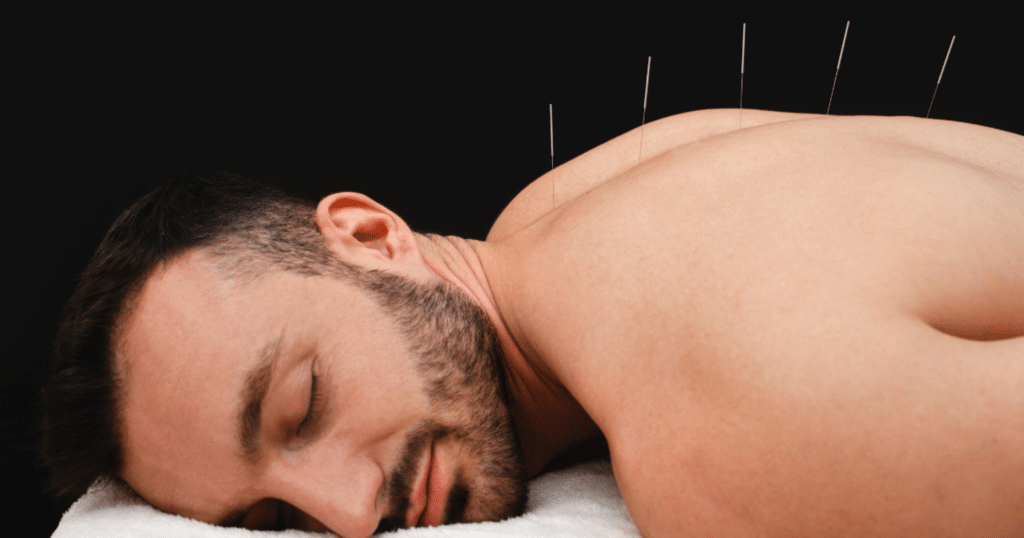 how-acupuncture-helps-with-slipped-disc