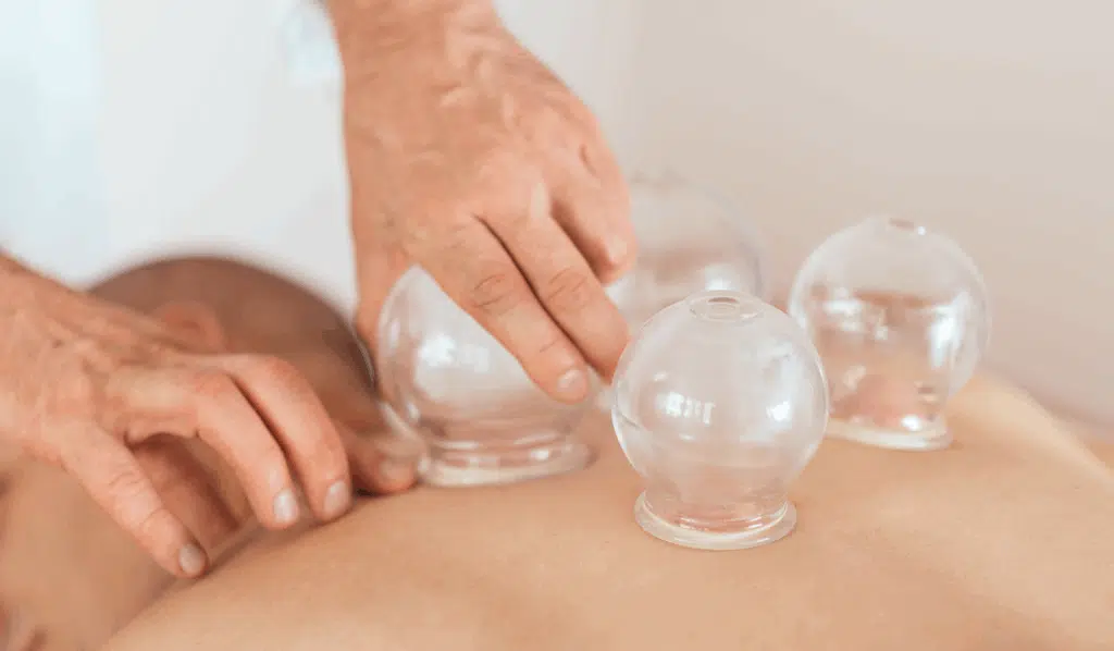 Cupping Techniques for Optimal Lymphatic Drainage