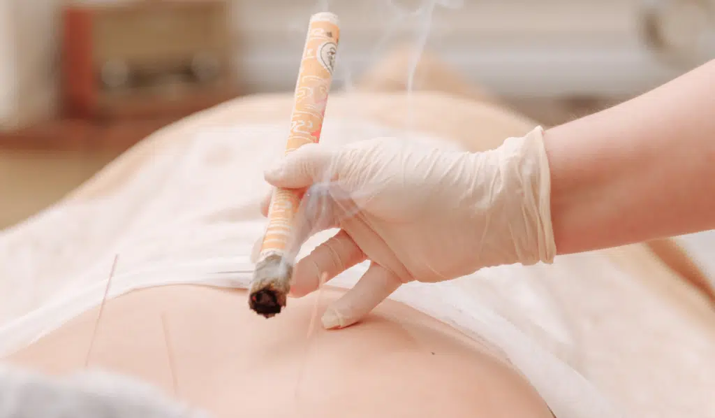 Exploring Moxibustion in Acupuncture_ Benefits, Uses, and What to Expect