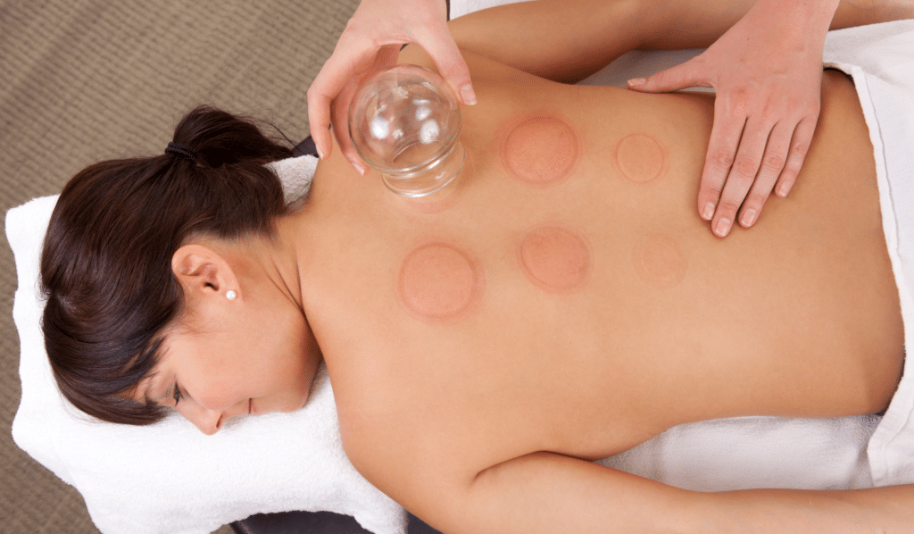 How Cupping Works in the Body