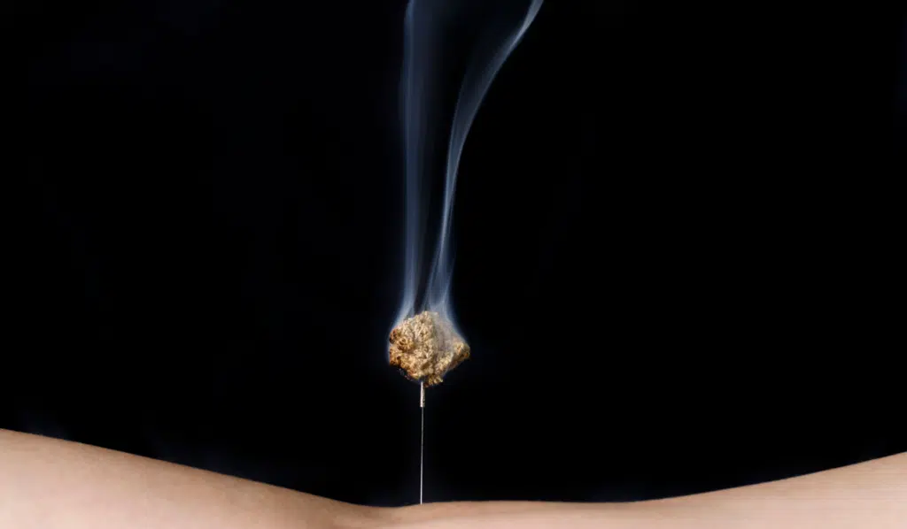 Origins of Moxibustion in Acupuncture_ How the Practices Came Together and Remain Common Today