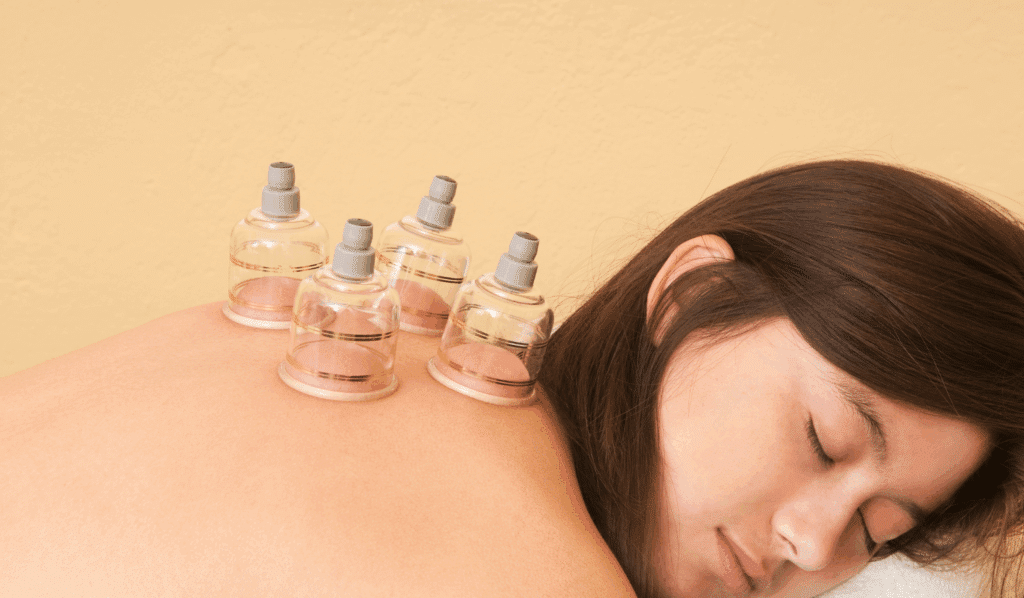 The Benefits of Cupping for Lymphatic Drainage