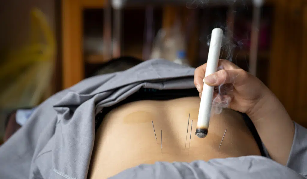 Why Moxibustion and Acupuncture Work Better Together