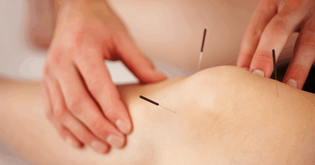 how-acupuncture-may-affect-blood-pressure