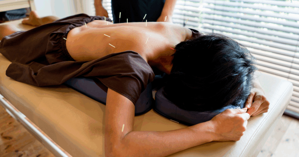 how-often-should-you-get-acupuncture