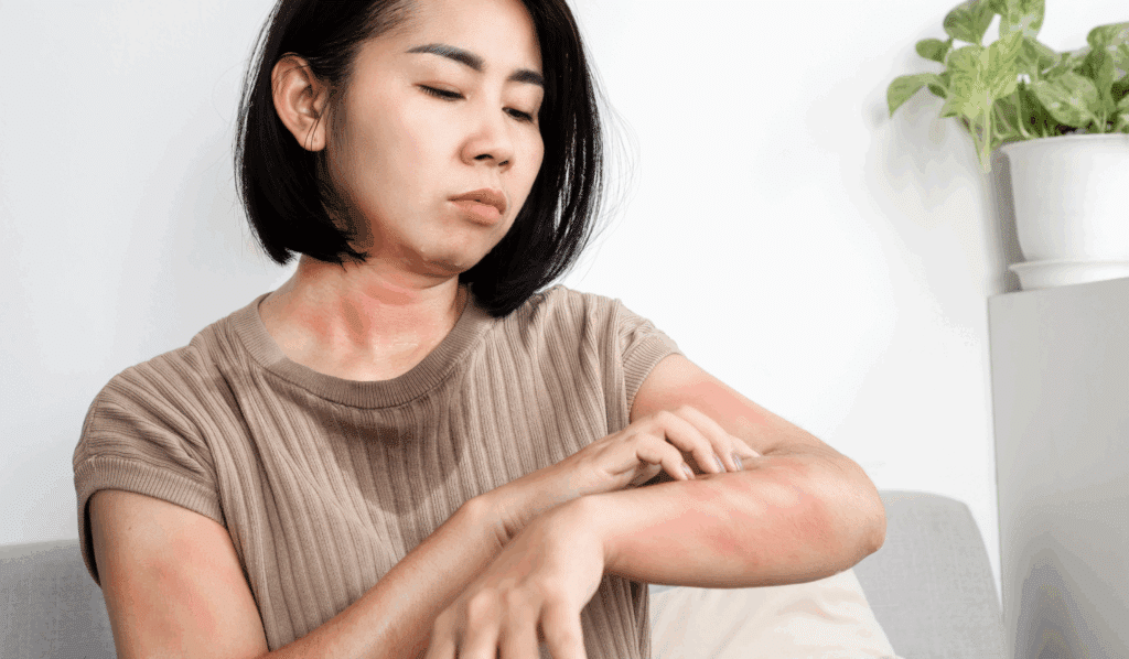 Recognizing TCM Patterns Behind Heat Illness