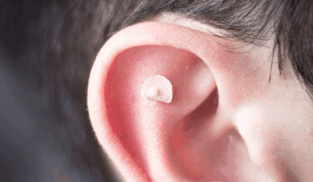Understanding How Ear Seeds Work for Weight Management