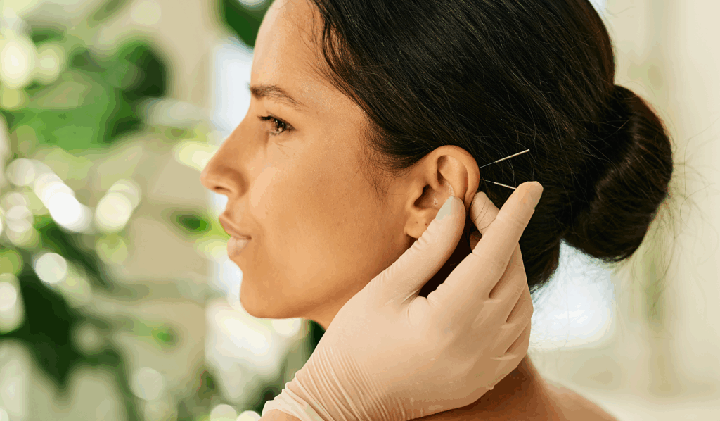 What is Auricular (Ear) Acupuncture