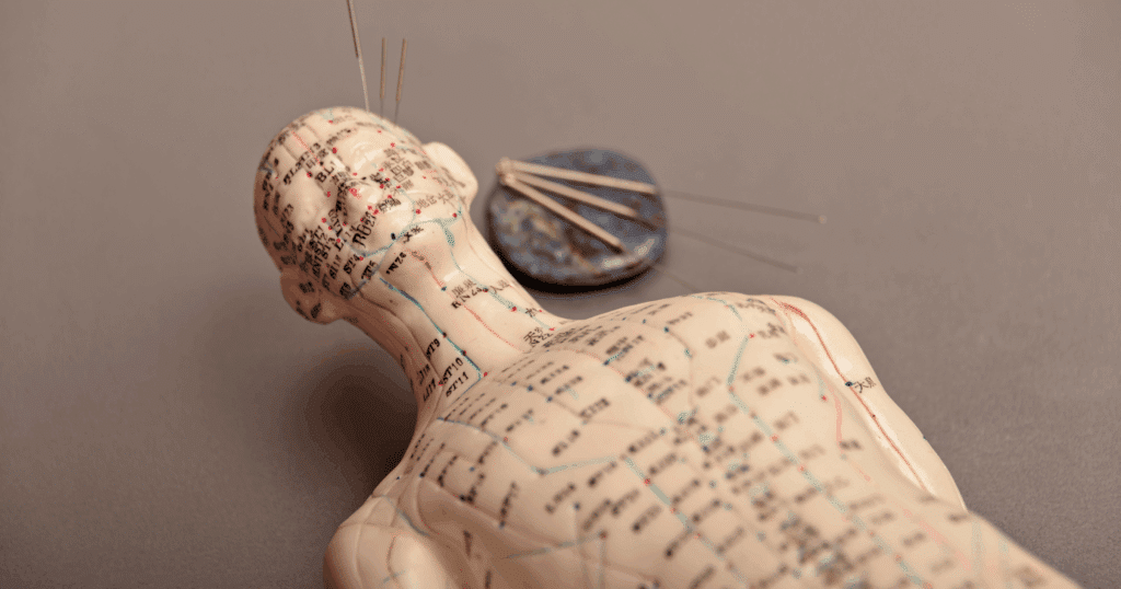 scientific-evidence-and-research-on-acupuncture-effectiveness