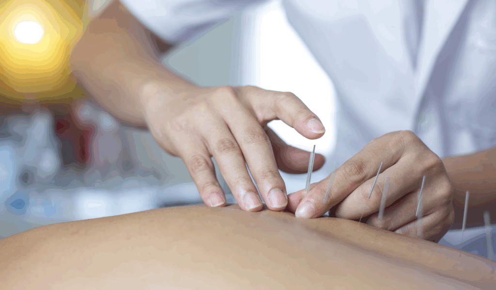 The Benefits of Practicing Meditation with Acupuncture