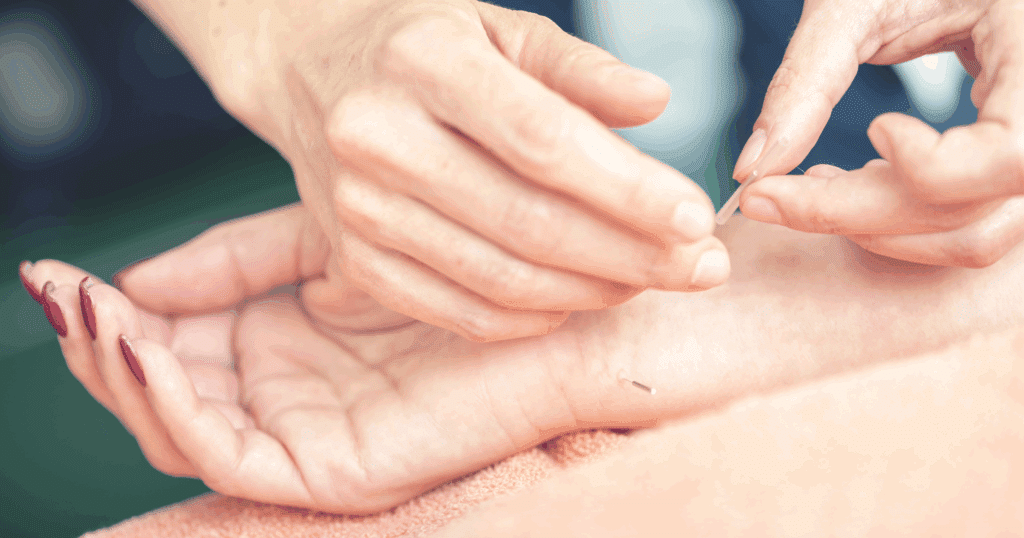 how-acupuncture-works-for-morning-sickness