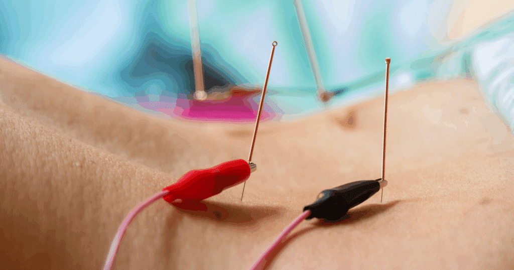 treatment-techniques-and-acupoint-selection