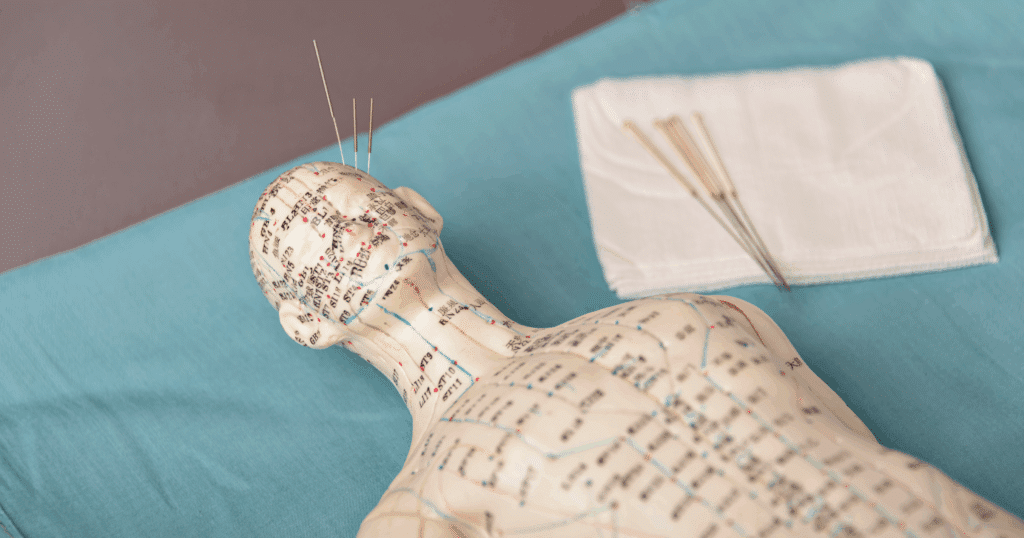 fundamentals-of-traditional-chinese-medicine