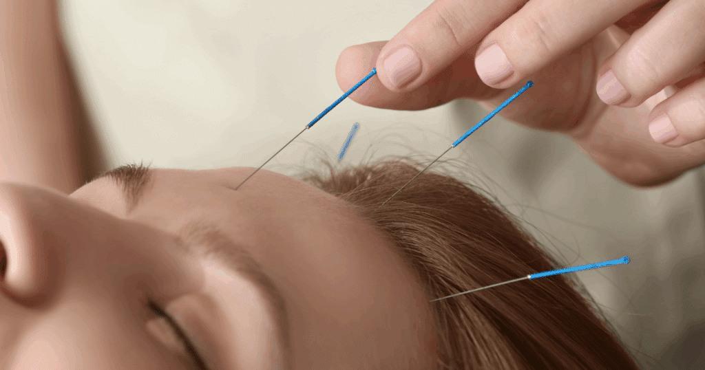understanding-allergies-and-acupuncture