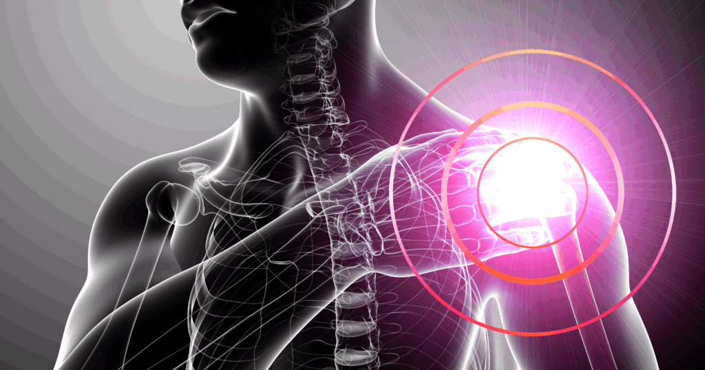 understanding-frozen-shoulder-adhesive-capsulitis