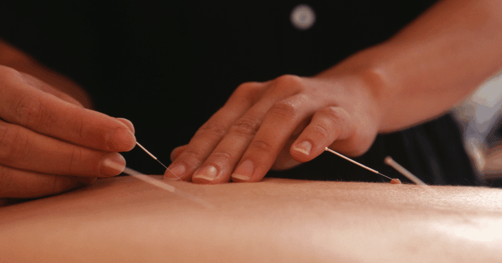 how-acupuncture-supports-immune-function-mechanisms