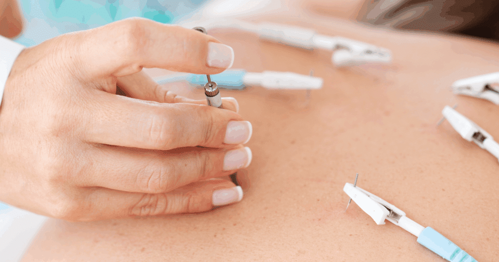 practical-application-when--how-to-use-acupuncture-for-immune-support