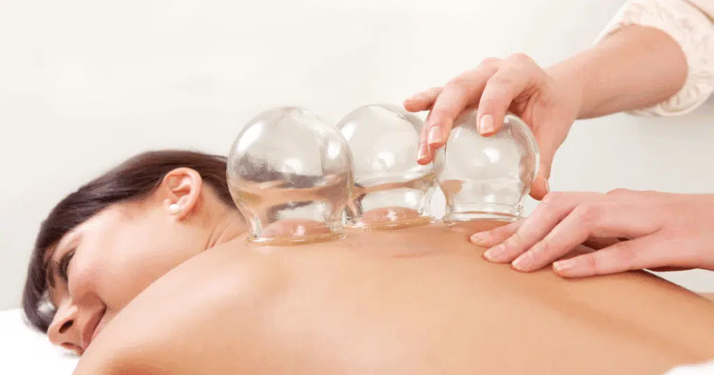 Cupping Methodology for Respiratory Health