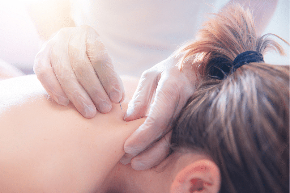 Getting the Best Acupuncture Treatment in NYC at ACA Acupuncture & Wellness Clinic