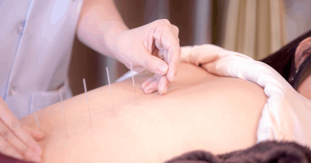 How Acupuncture Helps Manage Blood Sugar