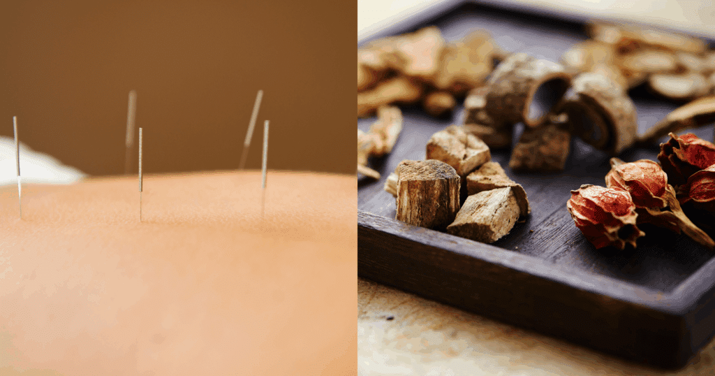 Natural Chinese Medicine Treatments for Kidney Stones