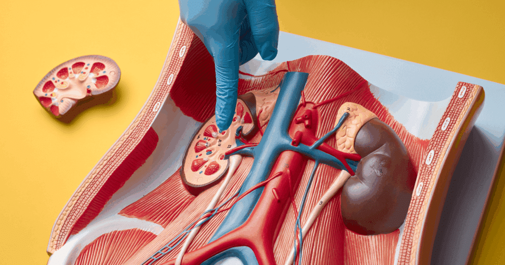Understanding Kidney Stones_ Causes, Symptoms, and Conventional Treatments